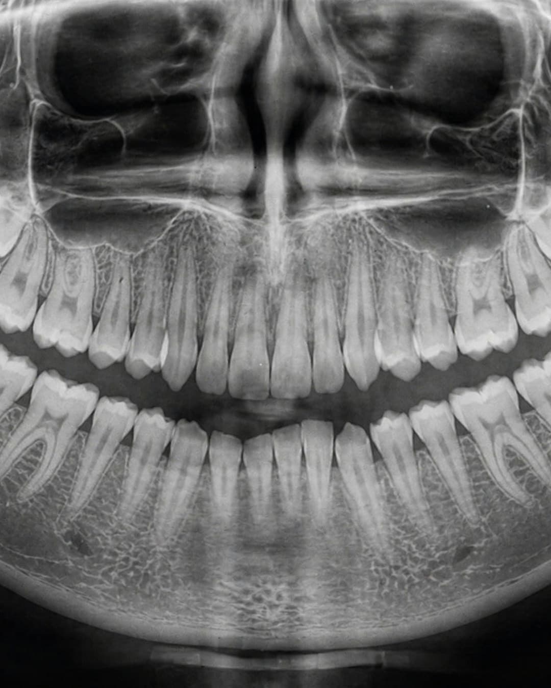 It Has Been Years treatments at Johns Creek Family Dentistry